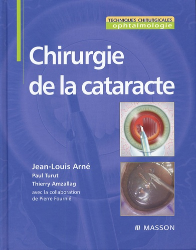  - 9782294017216-chirurgie-cataracte_g