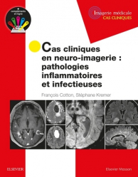 Dernières parutions dans , Cas cliniques en neuro-imagerie : pathologies inflammatoires et infectieuses 