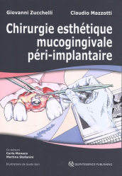 Dernières parutions dans , Chirurgie Esthétique Mucogingivale Péri-implantaire (coffret 2 volumes) 