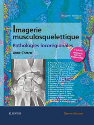 La couverture et les autres extraits de Imagerie musculosquelettique