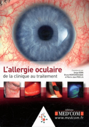 Dernières parutions dans , L'allergie oculaire : de la clinique au traitement 