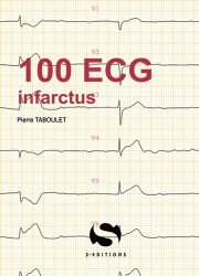 Dernières parutions dans , 100 ECG autour de l'infarctus 
