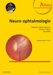 Dernières parutions dans , Neuro-ophtalmologie 