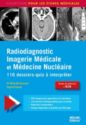 Dernières parutions dans , Radiodiagnostic, Imagerie Médicale et Médecine Nucléaire 