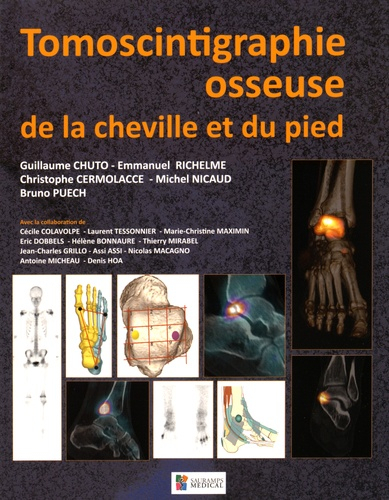 Tomoscintigraphie osseuse de la cheville et du pied sauramps