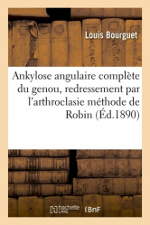 Ankylose angulaire complète du genou, redressement par l'arthroclasie méthode de Robin