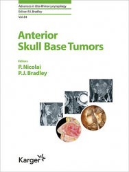 En promotion de la Editions karger : Promotions de l'éditeur, Anterior Skull Base Tumors