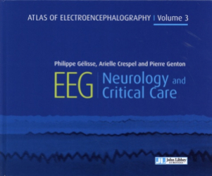 Vous recherchez les meilleures ventes rn Spécialités médicales, Atlas of electroencephalography - volume 3 - Neurology and critical care