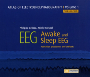 Vous recherchez les meilleures ventes rn Spécialités médicales, Atlas of electroencephalography - Tome 1, Awake and sleep eeg