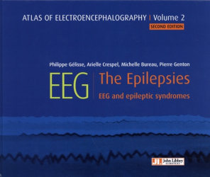 Atlas of electroencephalography Volume 2 : The Epilepsies