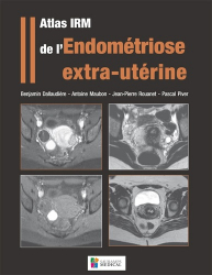 Atlas IRM de l'endométriose extra-utérine