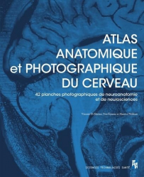 Vous recherchez les meilleures ventes rn Sciences fondamentales, Atlas anatomique et photographique du cerveau