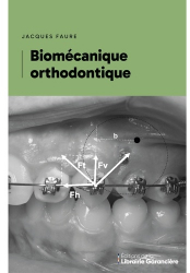 Biomécanique orthodontique