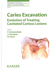 Vous recherchez des promotions en Dentaire, Caries Excavation: Evolution of Treating Cavitated Carious Lesions