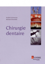 Chirurgie dentaire