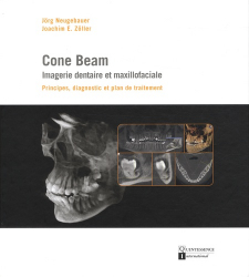 Cone Beam : imagerie dentaire et maxillofaciale