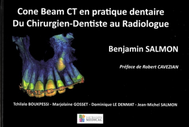 Cone Beam CT en pratique dentaire