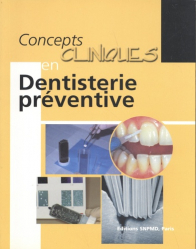 Concepts clinique en dentisterie préventive