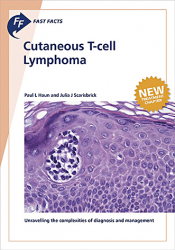 Vous recherchez des promotions en Spécialités médicales, Cutaneous T-cell Lymphoma