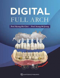 Digital full arch