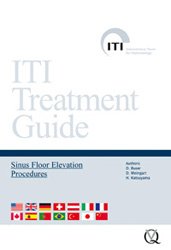 DVD ITI - Sinus floor elevation procedures