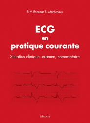 ECG en pratique courante