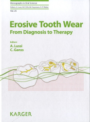 En promotion chez Promotions de la collection Monographs in Oral Science - karger, Erosive Tooth Wear