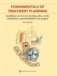 Fondamentals of Treatment Planning