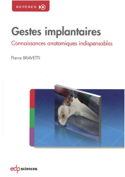Gestes implantaires
