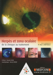 Herpès et zona oculaire de la clinique au traitement