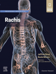 Vous recherchez les meilleures ventes rn Imagerie médicale, Imagerie médicale : Rachis