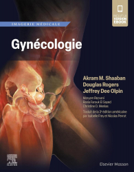 Imagerie médicale en gynécologie