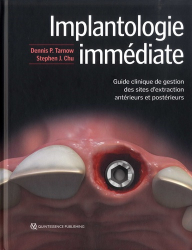 Implantologie Immédiate
