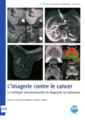 Imagerie contre le cancer