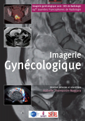 Imagerie gynécologique