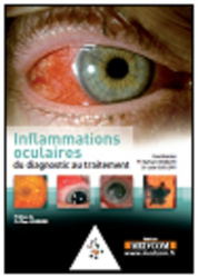 Inflammations oculaires du diagnostic au traitement
