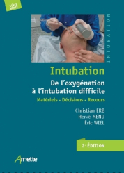 Intubation