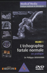 L'échographie foetale normale en pratique  Vol 1
