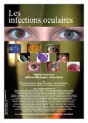 Les infections oculaires