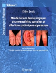Manifestations dermatologiques des connectivites, vasculites et affections systémiques apparentées Vol 1