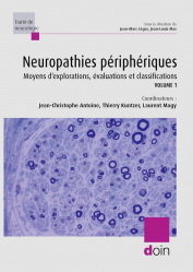 Vous recherchez les meilleures ventes rn Spécialités médicales, Neuropathies périphériques - volume 1