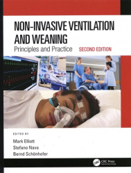 Non-Invasive Ventilation and Weaning