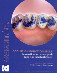 Vous recherchez les meilleures ventes rn Dentaire, Occlusion fonctionnelle : la mastication nous guide dans nos réhabilitations !