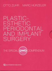 Plastic-esthetic periodontal and implant surgery