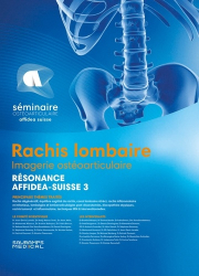 Rachis lombaire - Imagerie ostéoarticulaire