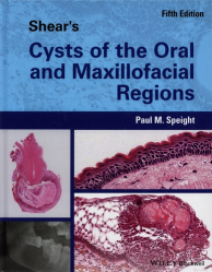 Shear's Cysts of the Oral and Maxillofacial Region