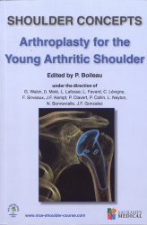 Shoulder concepts arthroplasty for the young arthritic shoulder