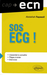 SOS ECG !