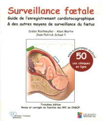 Surveillance foetale - guide de l'enregistrement cardiotocographique & des autres moyens de surveillance du foetus
