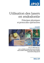Utilisation des lasers en endodontie
